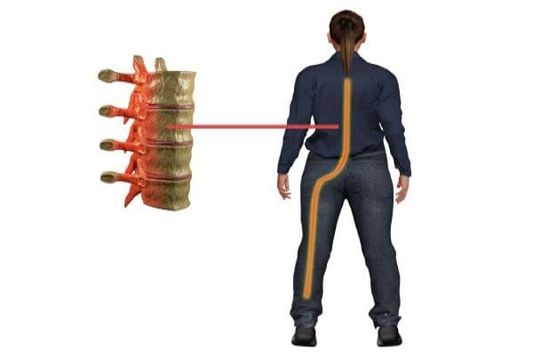 Best hospital for sciatica treatment and cure in bhuj kutch